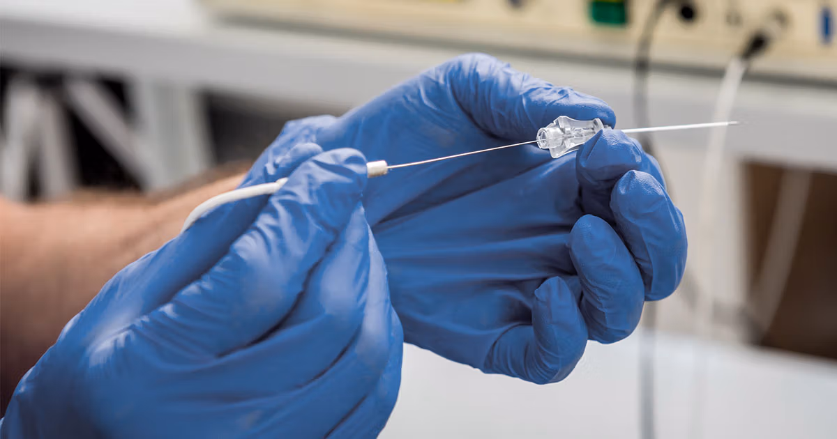 Aflutter Ablations | Ibrahim Heart Clinic