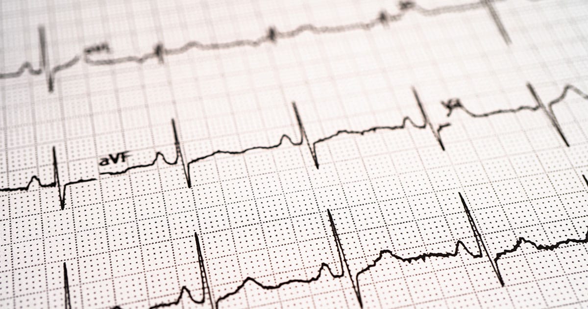 EKG | Ibrahim Heart Clinic